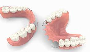 Partial Dentures
