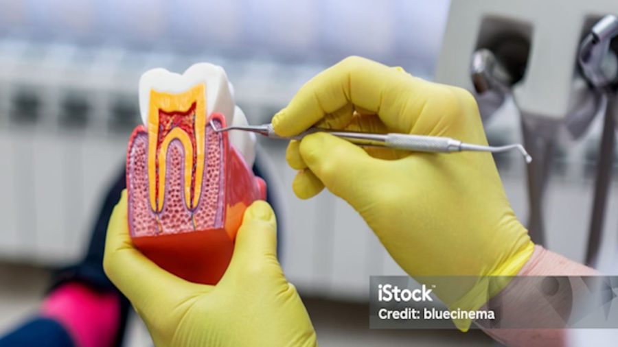Gum Disease